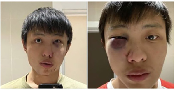 1583833173520953.jpg 2.jpg